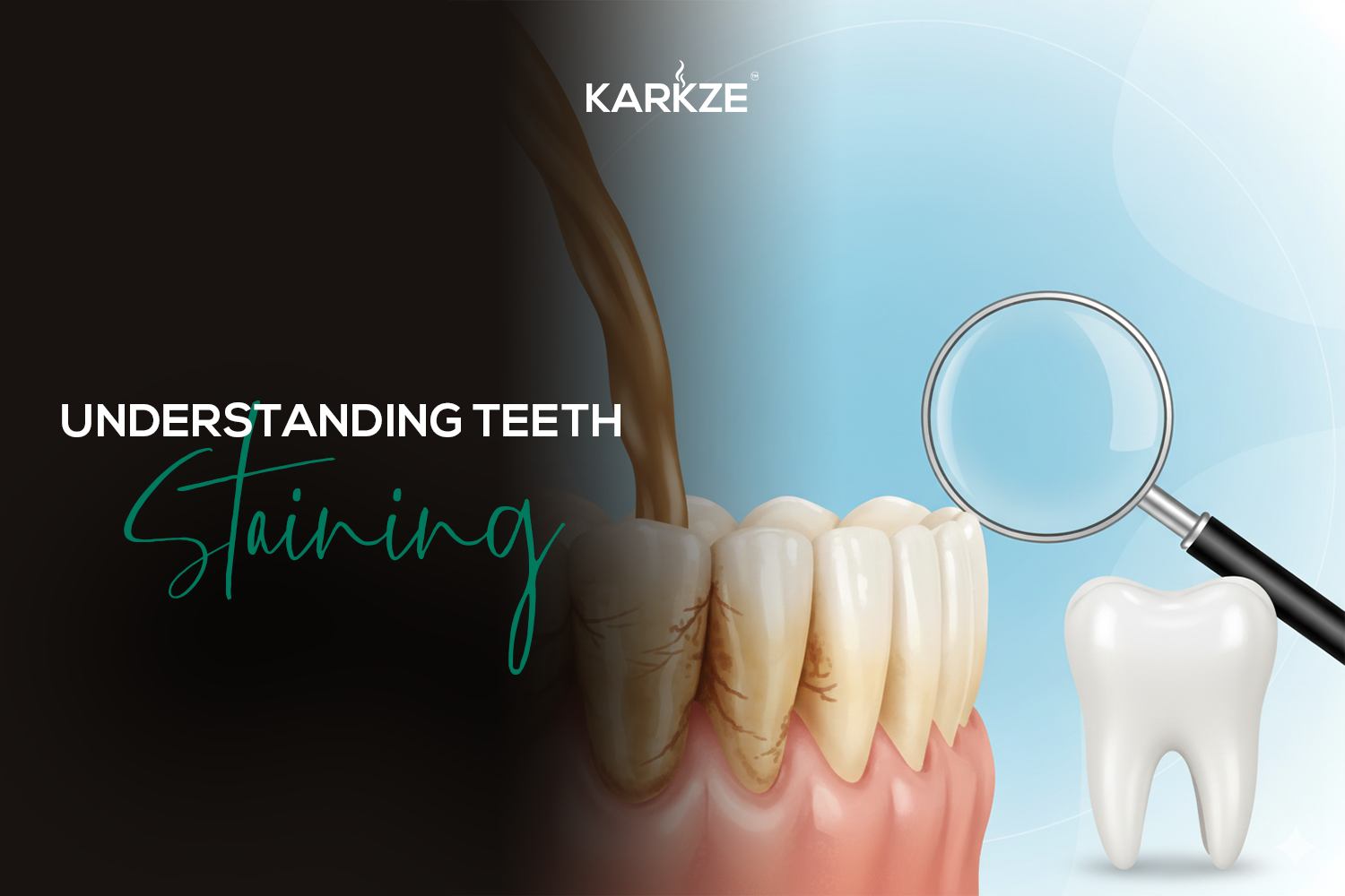 Understanding Teeth Staining (The “Why”)